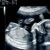 USG podczas ciąży: co należy wiedzieć?